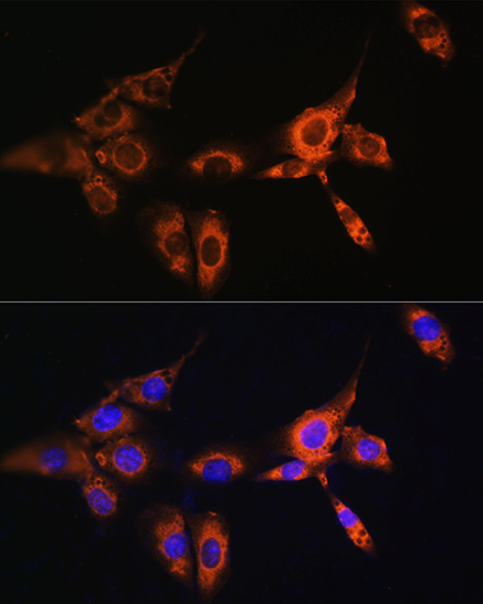 ARRB2 antibody