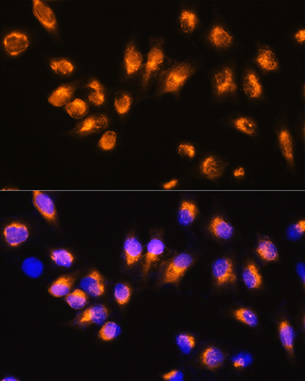 ARRB2 antibody