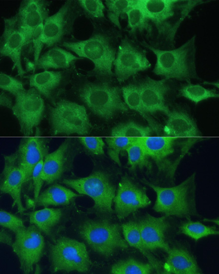 PTPN22 antibody