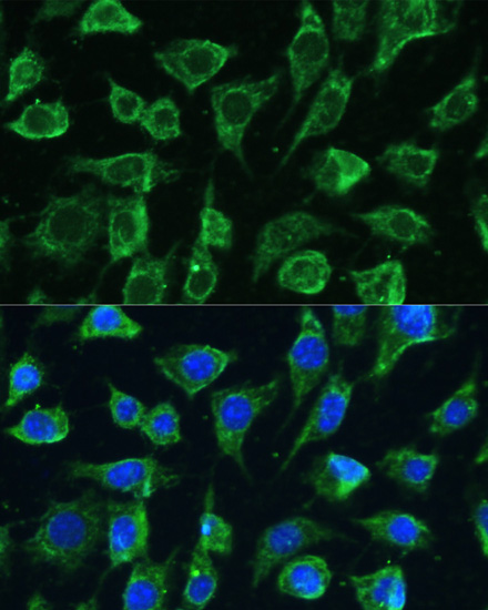 PTPN22 antibody