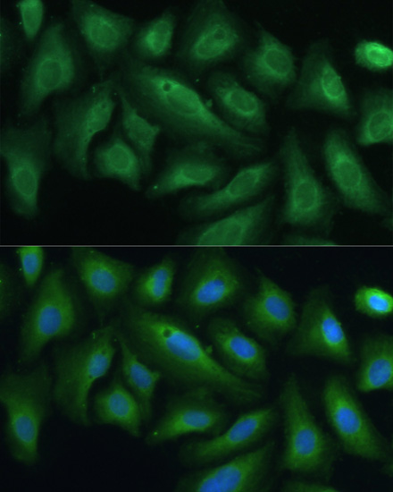 PTPN22 antibody