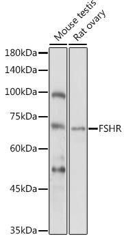 FSHR antibody