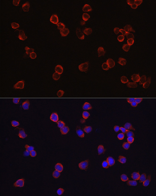 CD4 antibody