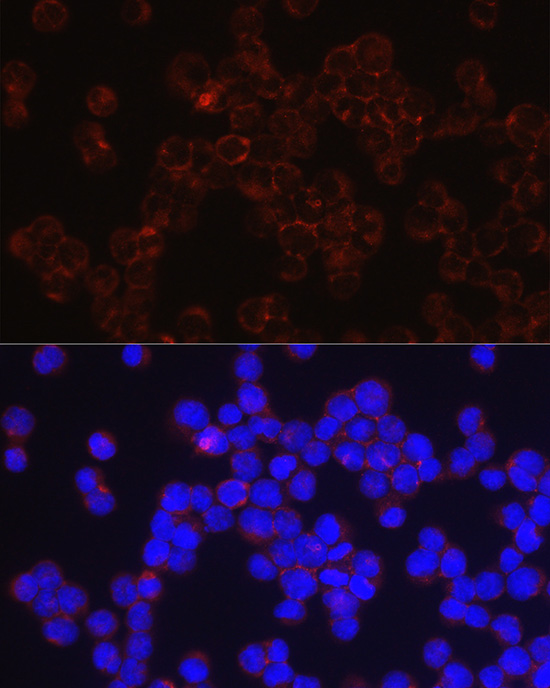 CD4 antibody