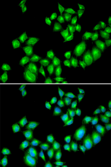 DRD3 antibody