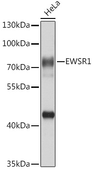 EWSR1 antibody