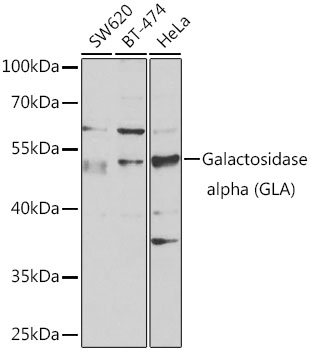 GLA antibody
