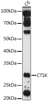 CTSK antibody