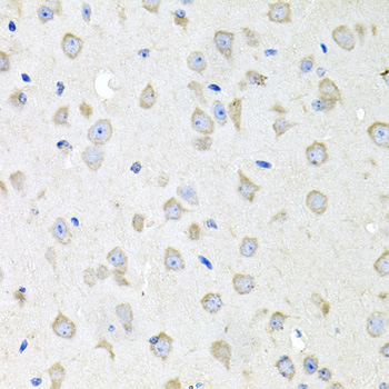 CTSK antibody