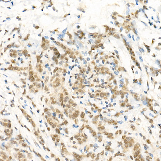 RGS2 antibody