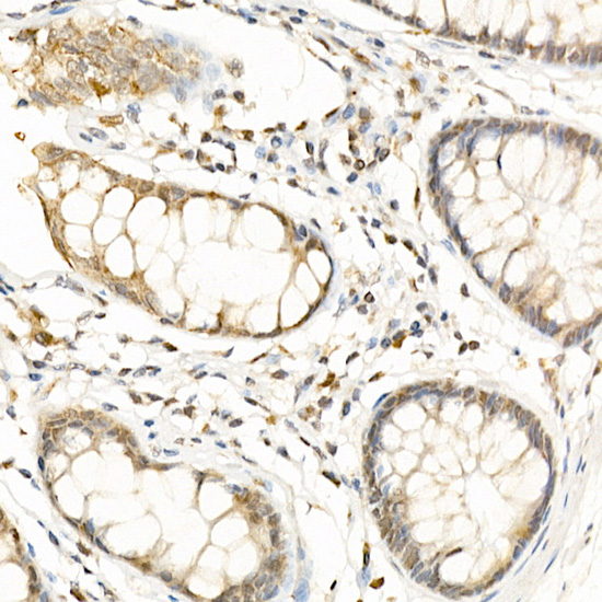 RGS2 antibody