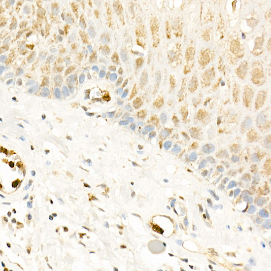 RGS2 antibody