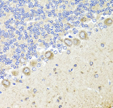 NTRK1 antibody
