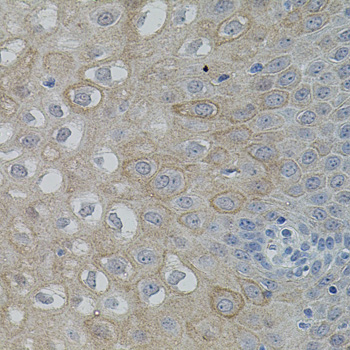 PTK2 antibody