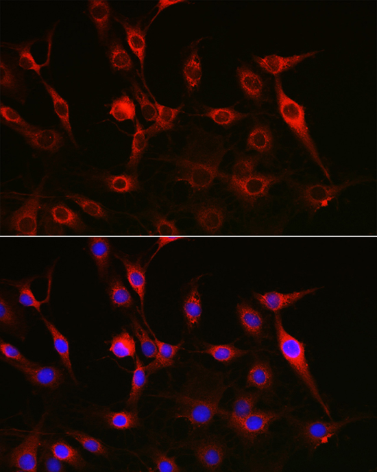PTK2 antibody