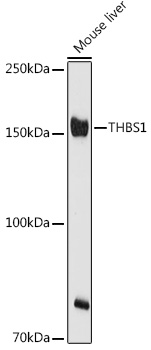 THBS1 antibody