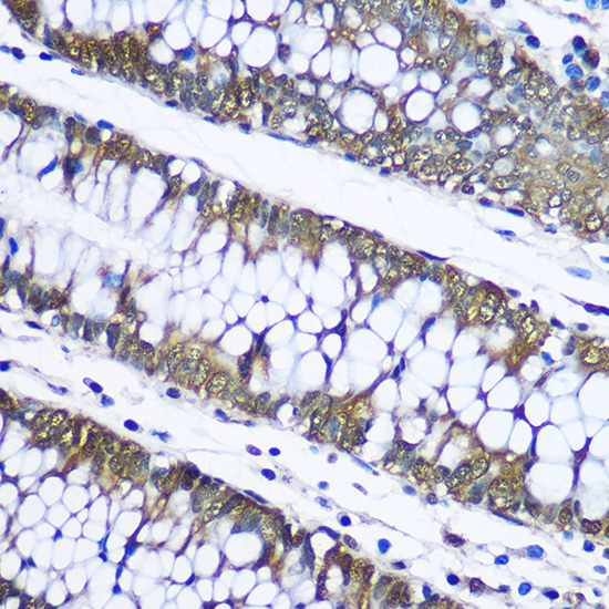 UBB antibody