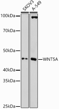 Wnt5a antibody