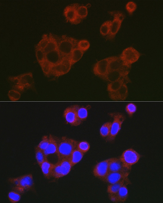 CFH antibody