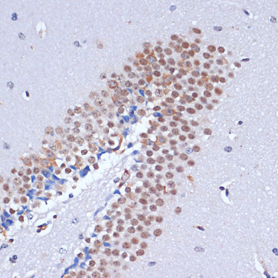 DNMT3L antibody