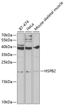HSPB2 antibody