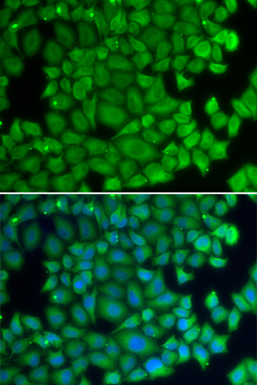 HSPB2 antibody