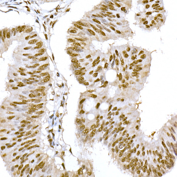 GTF2F1 antibody