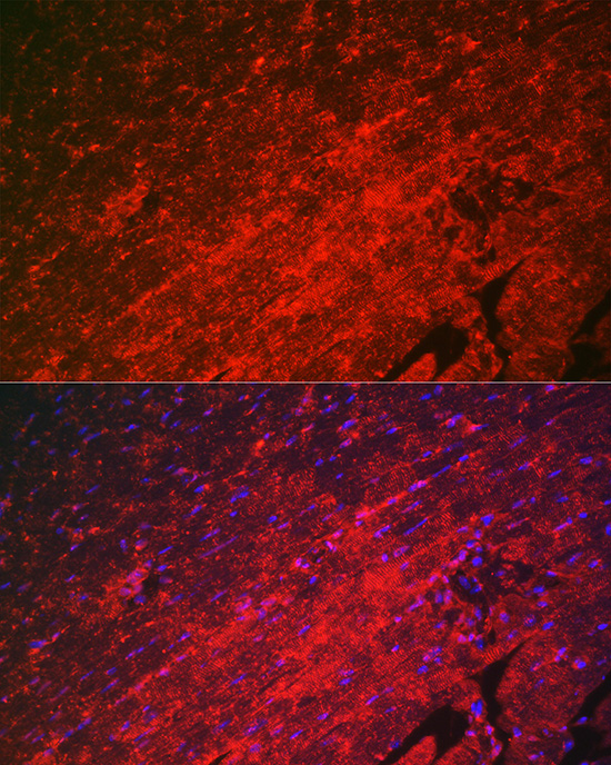 HSPB8 antibody