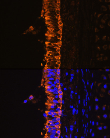 KRT7 antibody