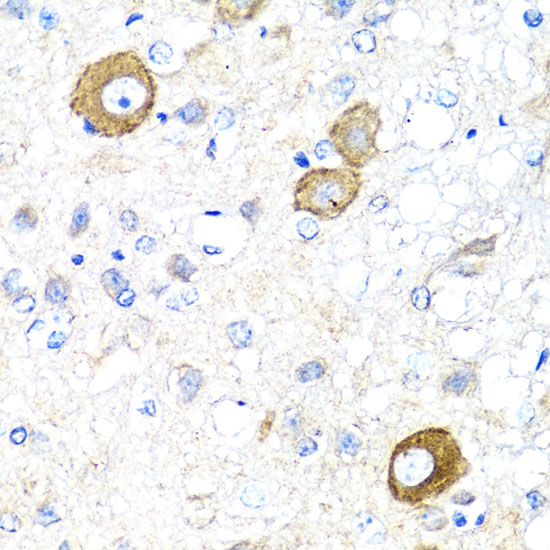 NRG4 antibody