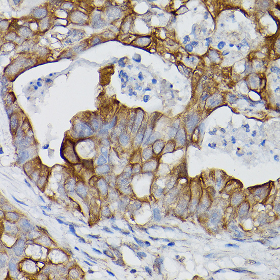 IL18R1 antibody