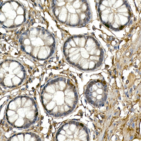 NEUROG3 antibody