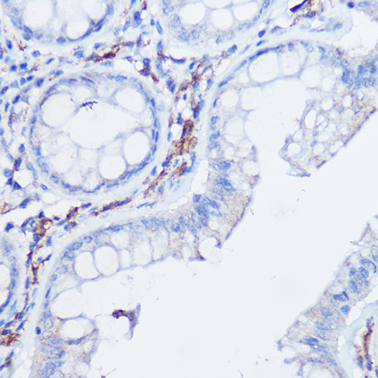 CX3CR1 antibody