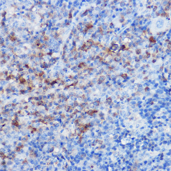CX3CR1 antibody
