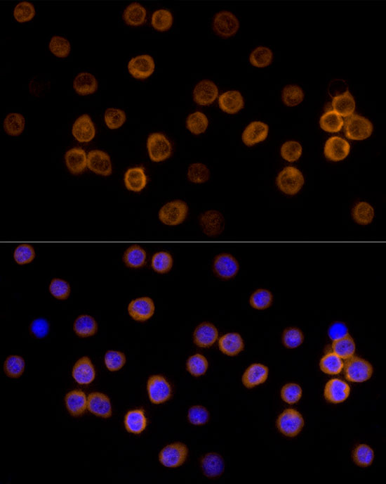 CX3CR1 antibody