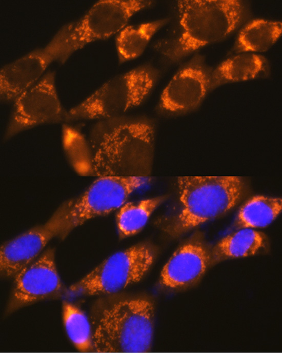 EIF4G2 antibody