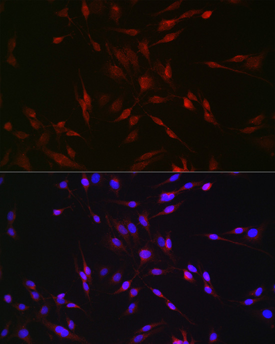 EDA antibody