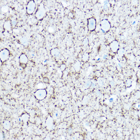 GAD1 antibody