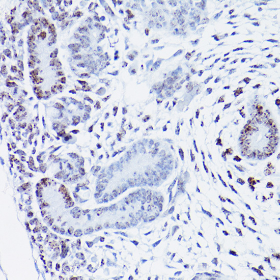 HMGA2 antibody