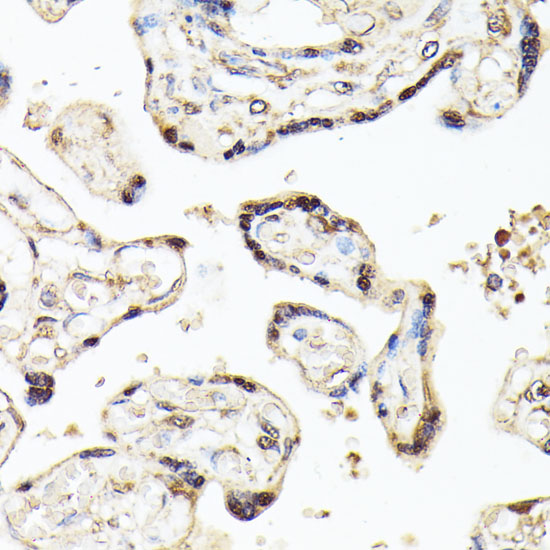 KLF5 antibody