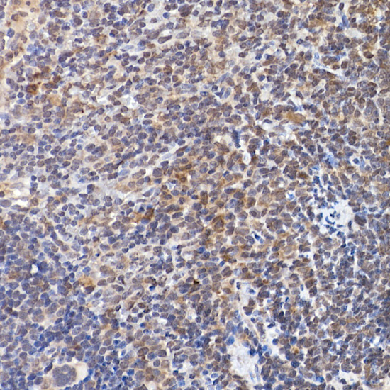 NFATC2 antibody