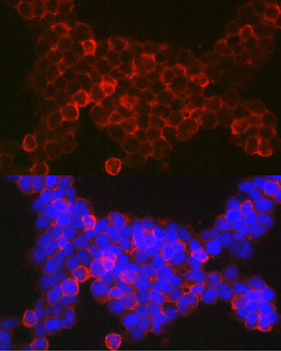 NFATC2 antibody