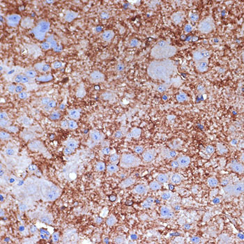 NPY antibody