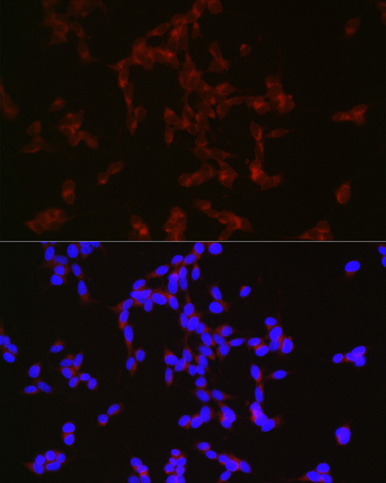 NPY antibody