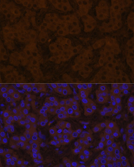TTR antibody