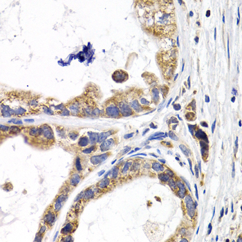 FABP3 antibody