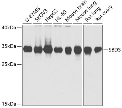 SBDS antibody