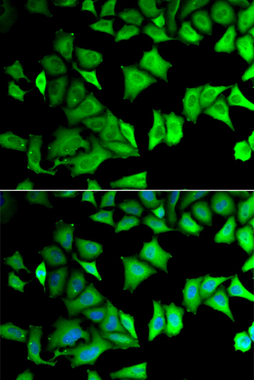 RPS12 antibody