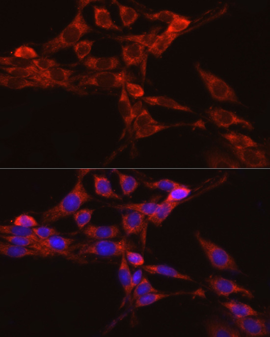 IRAK4 antibody