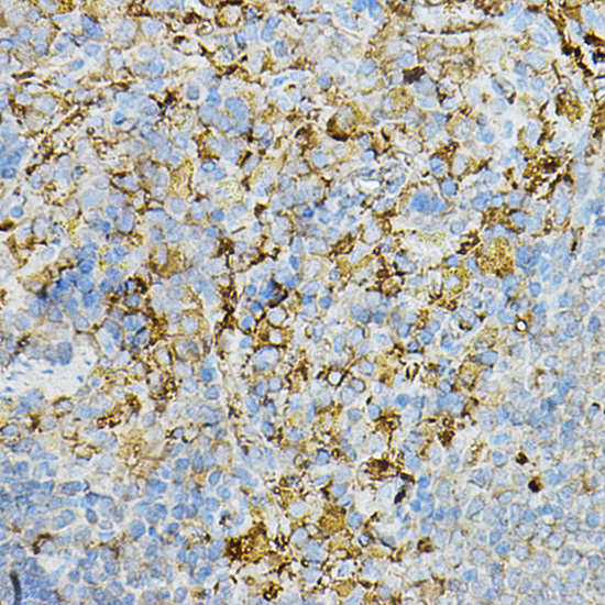 IRAK4 antibody